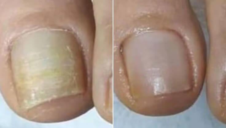 Margaret's before and after
